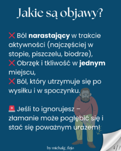 Jakie są objawy złamania zmęczeniowego? Fizjoterapia ząbki